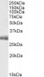 FGF5 (isoform1) Antibody (C-Term)