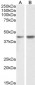 NPHS2 / SRN1 Antibody (C-Term)