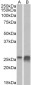 apolipoprotein D (aa70-80) Antibody (internal region)