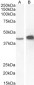 AMACR Antibody (C-Term)