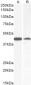 AMACR Antibody (C-Term)