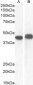 AMACR (aa312-326) Antibody (internal region)