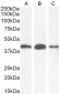 AMACR (aa312-326) Antibody (internal region)