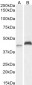 RNF13 / RZF (isoform 1 and 3) Antibody (C-Term)
