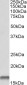 Cystatin B / Stefin B Antibody (C-Term)