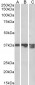 Arginase I Antibody (C-Term)