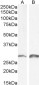 Snail homolog 1 / SNAI1 Antibody (N-Term)