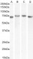 TGFBI Antibody (internal region)