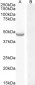 CETP Antibody (N-Term)