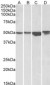 Goat Anti-ILK (Restricted sale due to demands of patent holder) Antibody