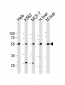 BMPR1A Antibody (N-term)
