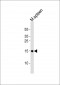 POLR2H Antibody (N-term)