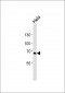 TNFRSF8 Antibody (N-term)