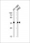 MRGPRX3 Antibody (N-term)
