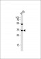 OTX2 Antibody (Center)