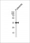 FOLR2 Antibody (N-term)