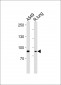 IDUA Antibody (Center)