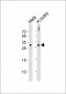 DIRAS3 Antibody