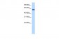 ZNF394 antibody - N-terminal region