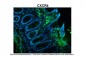CXCR4 antibody - N-terminal region