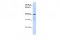 CXCR4 antibody - N-terminal region