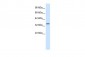 HHEX antibody - middle region