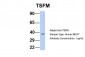 TSFM antibody - middle region