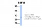 TSFM antibody - middle region