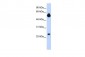 NOTCH4 antibody - middle region