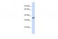 EWSR1 Antibody - C-terminal region