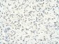 HDAC1 antibody - middle region