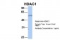 HDAC1 antibody - middle region