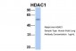 HDAC1 antibody - middle region