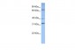 SUZ12 antibody - middle region