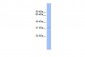 CNOT7 antibody - middle region