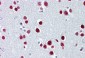 TUB antibody - N-terminal region