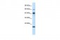 ZNF24 antibody - middle region