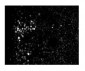 ZFHX1B antibody - N-terminal region