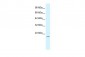 FOXP2 antibody - N-terminal region