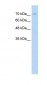 FOXP2 antibody - N-terminal region