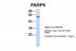 PARP6 antibody - N-terminal region