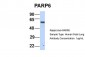 PARP6 antibody - N-terminal region