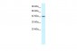 ATF2 antibody - C-terminal region