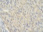 SIAH1 antibody - N-terminal region