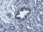RCOR1 antibody - middle region