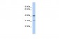 YBX1 antibody - middle region