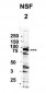 YBX1 antibody - middle region