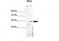 YBX1 antibody - middle region