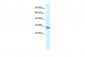 FHL2 antibody - C-terminal region