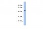 CBX8 antibody - N-terminal region